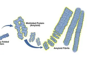 AL Amyloidosis: Latest Research, Diagnosis, and Treatment Advances (2025)